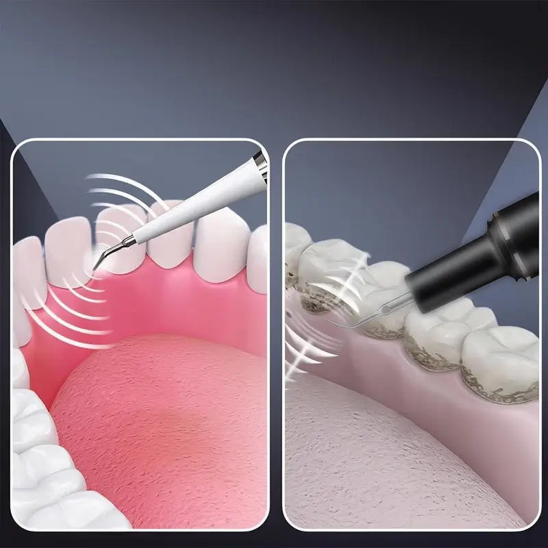 Cepillo de Dientes Eléctrico 2 en 1 para Adultos con Punta Ultrasónica para Eliminar Sarro, Recargable USB