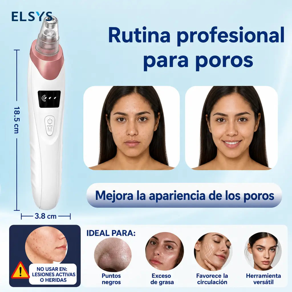 Aspirador de puntos negros recargable USB con 3 niveles de succión para limpieza facial profunda en casa o de viaje