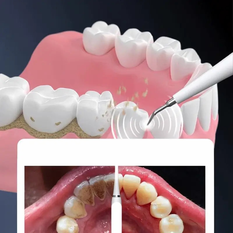 Cepillo de Dientes Eléctrico 2 en 1 para Adultos con Punta Ultrasónica para Eliminar Sarro, Recargable USB