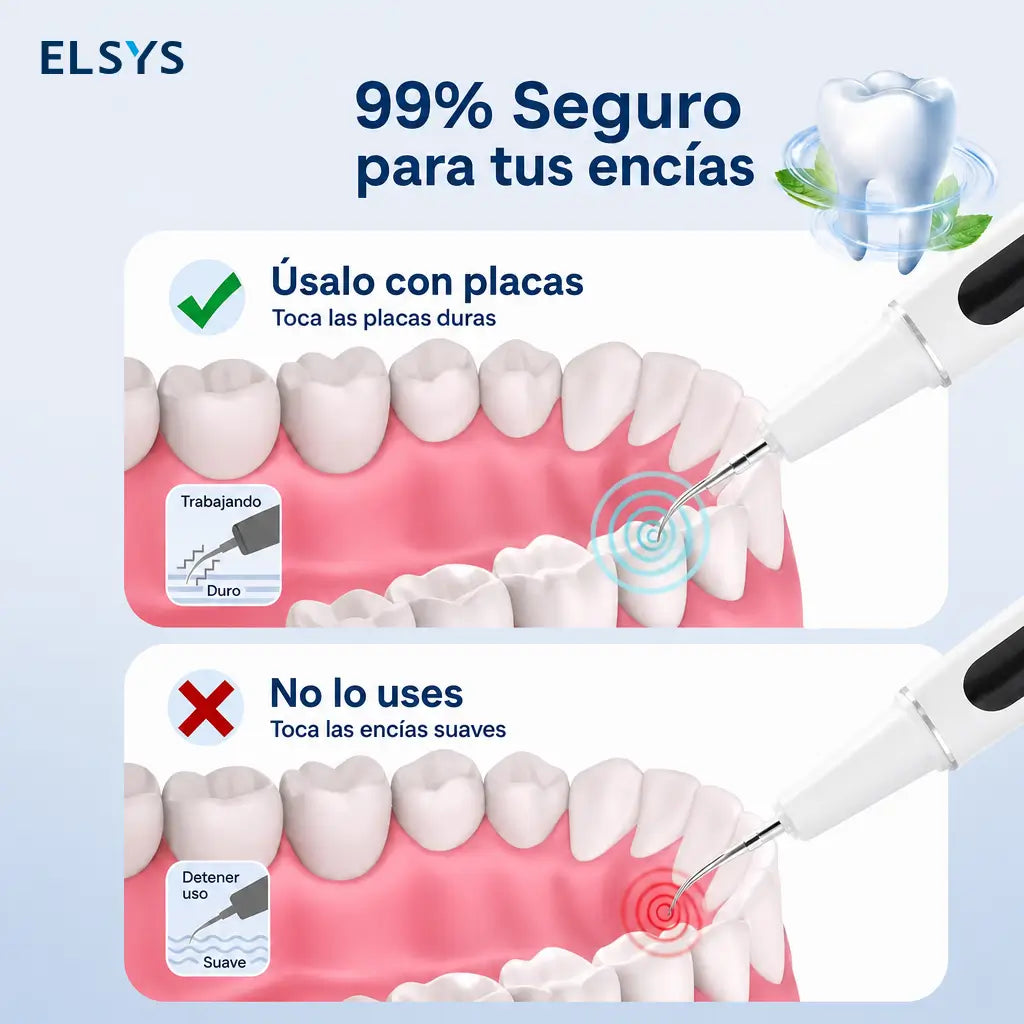 Raspador dental ultrasónico con vibración magnética, luz LED y cabezales reemplazables para higiene bucal diaria contra placa y sarro adultos
