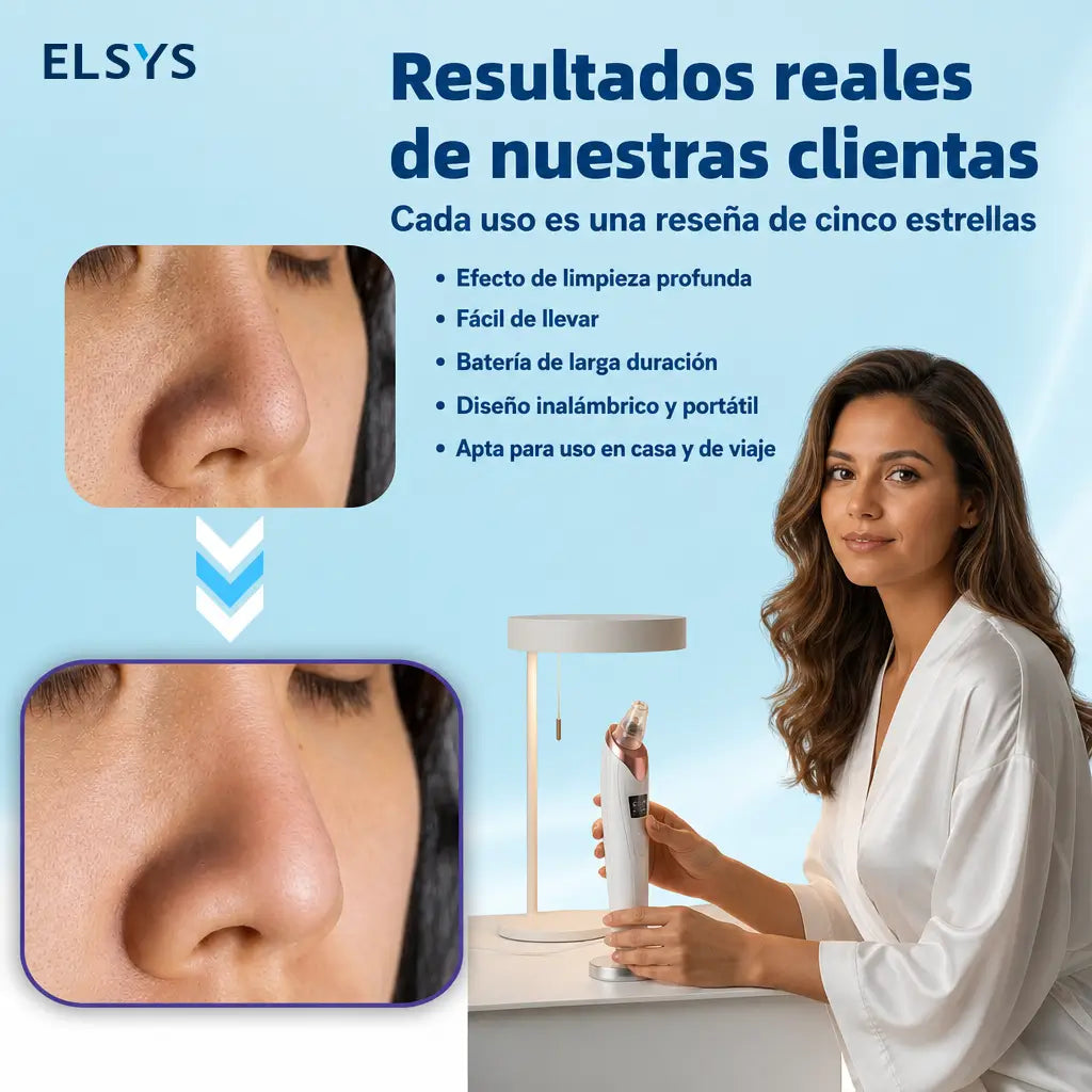 Aspirador de puntos negros recargable USB con 3 niveles de succión para limpieza facial profunda en casa o de viaje